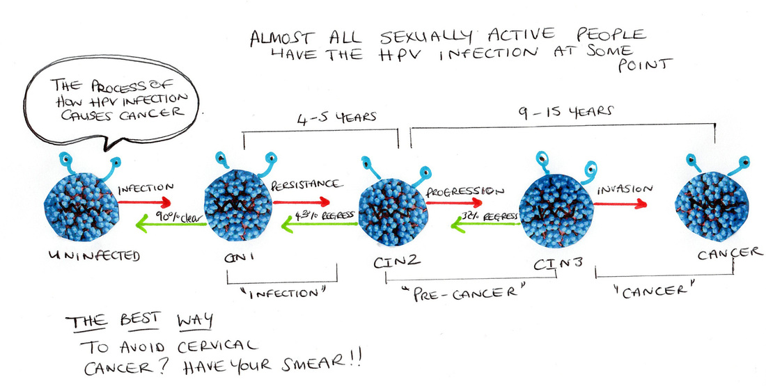 HPV progression diagram